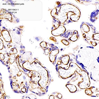 Anti-CD31 Κουνέλι PAB