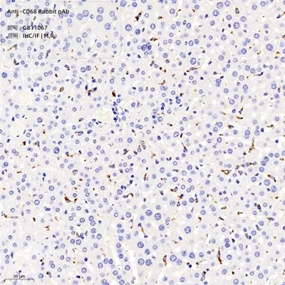 Anti-CD68 Κουνέλι PAB